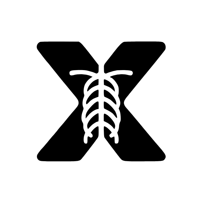 X-ray Interpreter